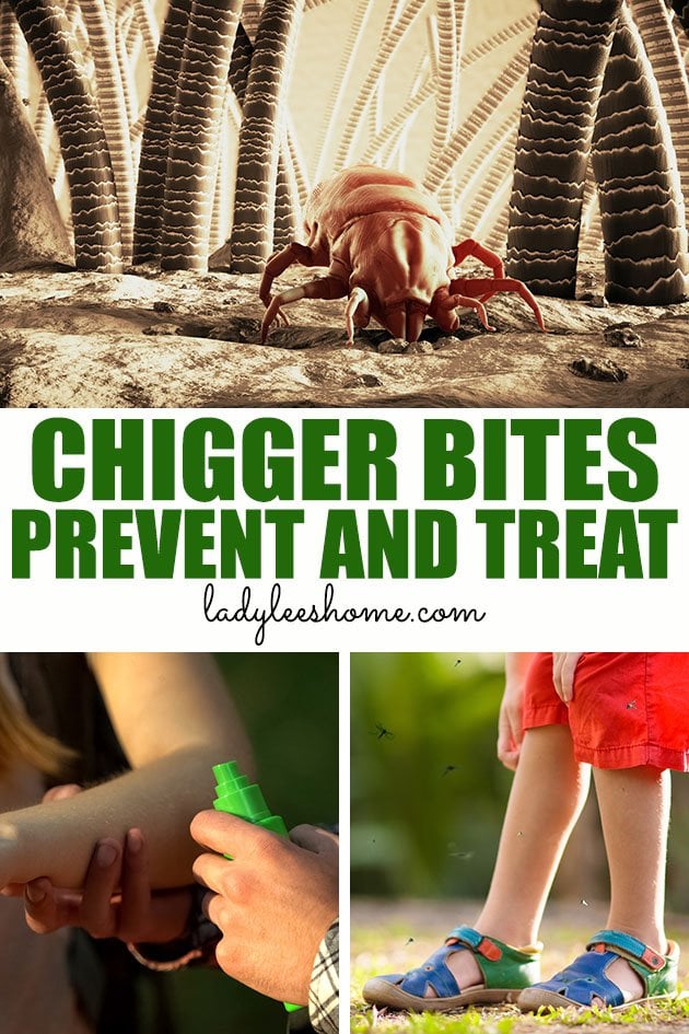 How To Prevent And Treat Chigger Bites Lady Lee S Home