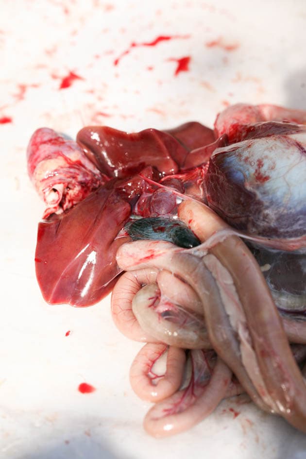 A view of the gallbladder.